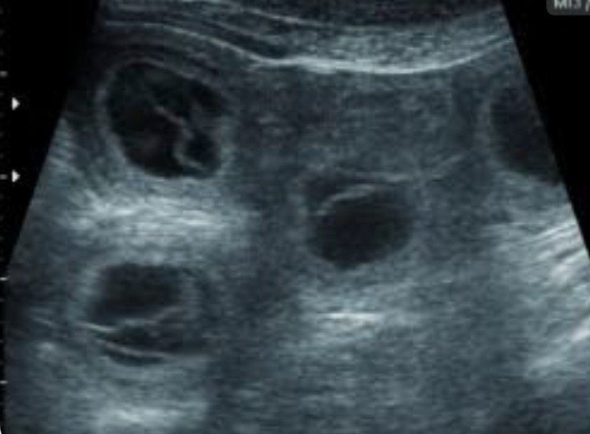 INFO PROCHAINE NAISSANCE